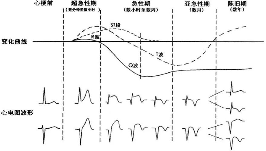 平滑重启_特征异常平滑插图